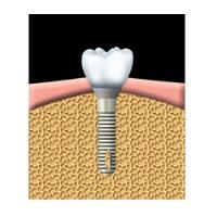 Ti Dental image 1